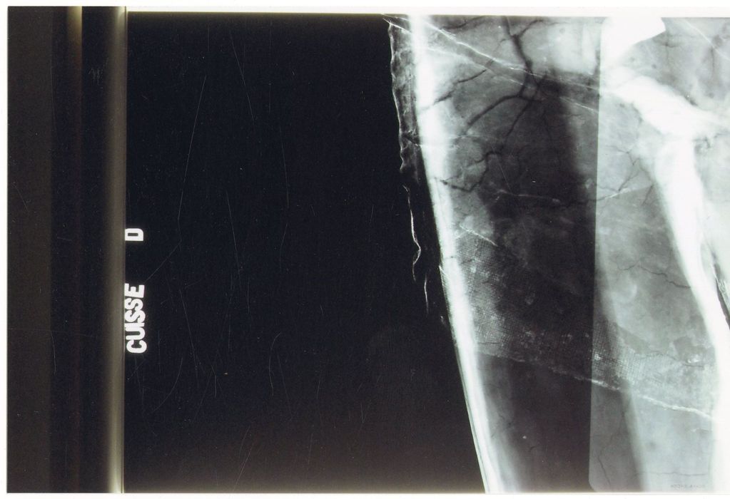 statue : Christ en croix (radiographie), détail cuisse droite