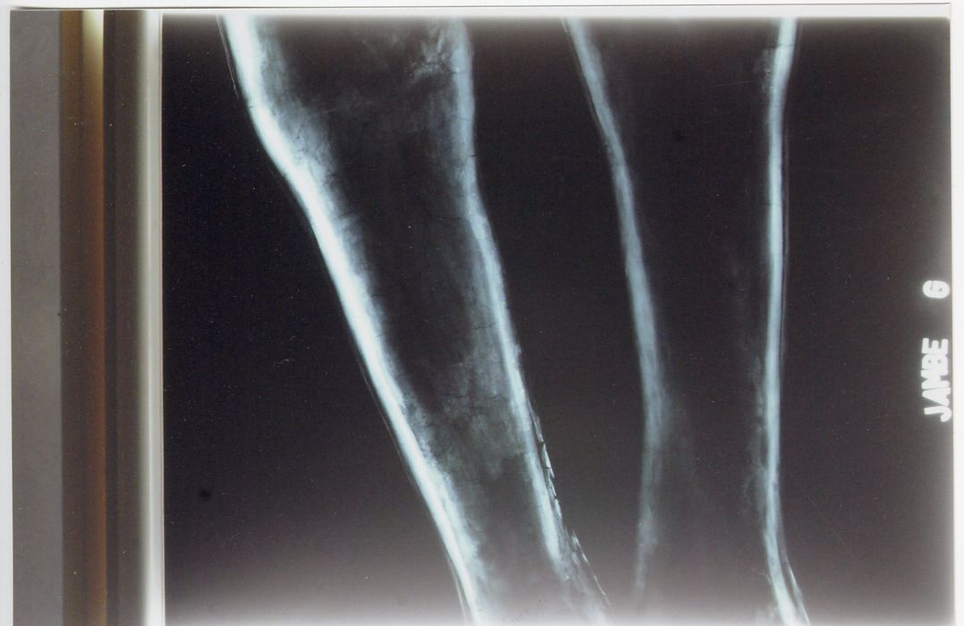 statue : Christ en croix (radiographie), détail jambe gauche