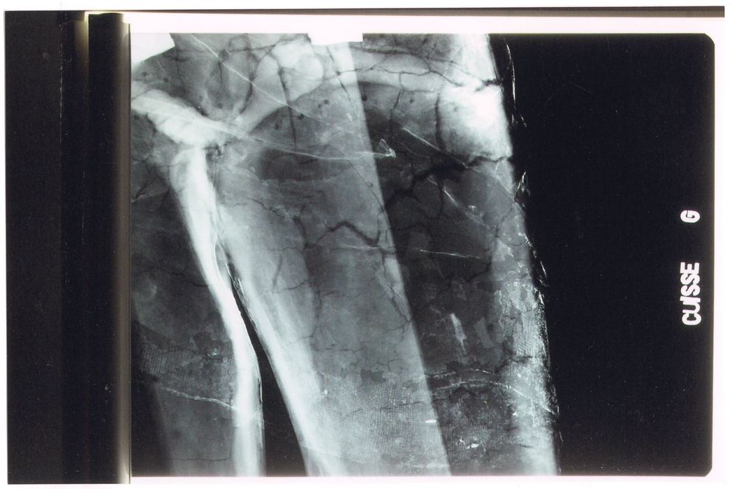 statue : Christ en croix (radiographie), détail cuisse gauche