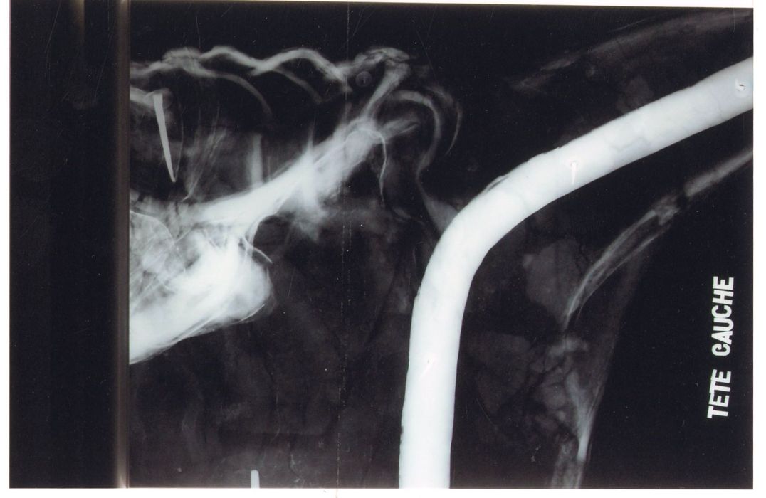 statue : Christ en croix (radiographie), détail