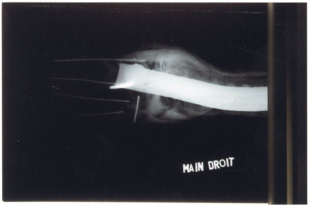 statue : Christ en croix (radiographie), détail main droite