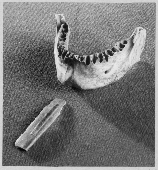 os de la machoîre supposée de saint Louis (relique)