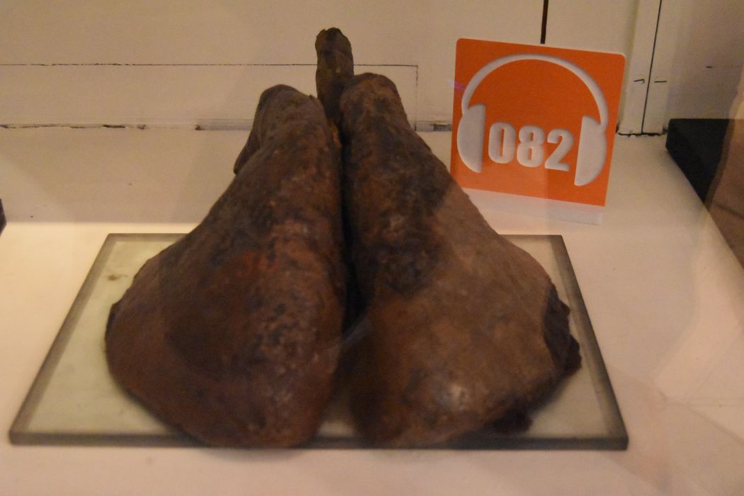 écorché : Poumons