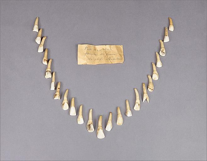 Ensemble (23 dents complètes).