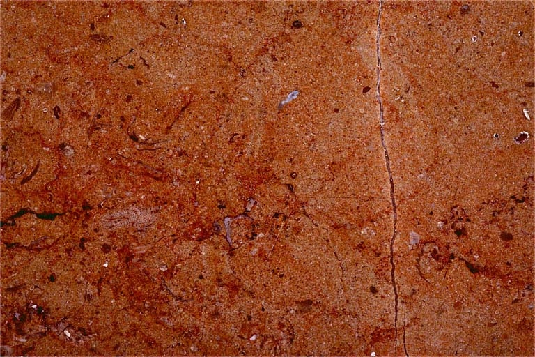 Echantillon de marbre de Montagna-le-Reconduit, actuellement dit marbre de Balanod. Musée d'Archéologie, Lons-le-Saunier.