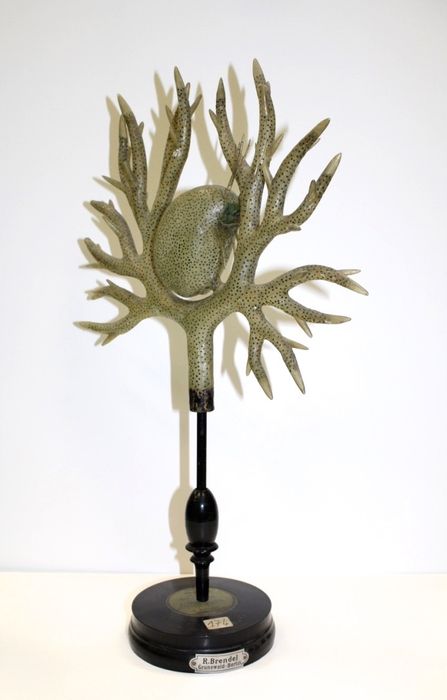 modèle de fleur articulé Brendel : utriculaire commune - © Ministère de la Culture (France), Direction Régionale des Affaires Culturelles de Bourgogne-Franche-Comté – Tous droits réservés