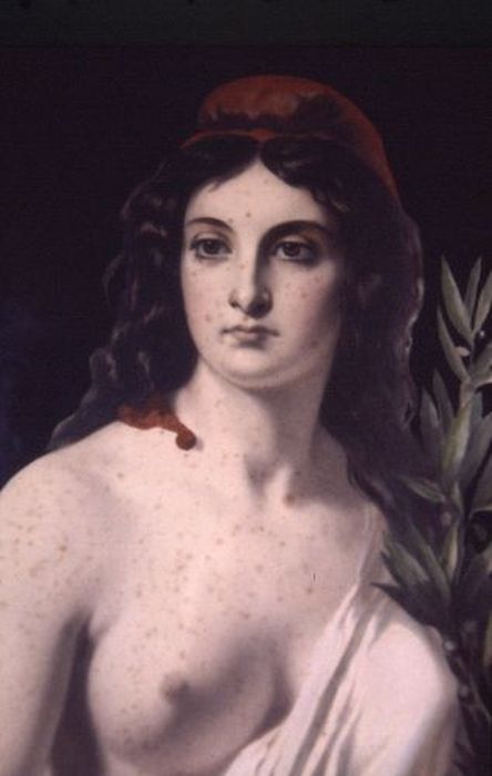 estampe : Marianne, vue partielle - © Ministère de la Culture (France), Conservation des antiquités et des objets d’art de l'Ariège – Tous droits réservés 